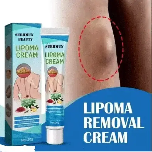 Best Subhmun Beauty Lipoma Removal Cream